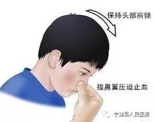 鼻子流血，原因、处理与预防