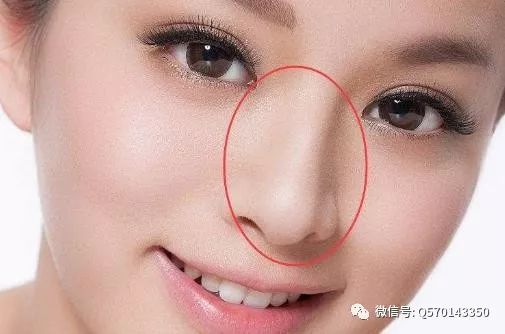 肉鼻子面相的特征及其解读