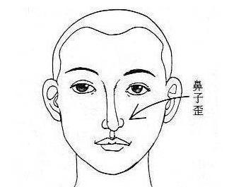 歪鼻子，一种独特魅力的象征