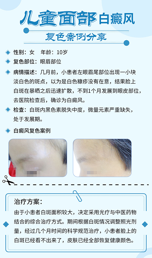 北京婴儿皮肤科白斑专家解析白斑病症与治疗策略