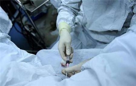 取卵后腹水手脚发麻，原因、处理与预防