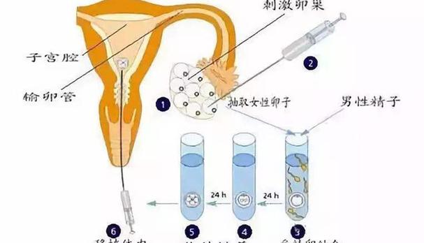卵子之旅，取卵过程与输卵管的角色解析